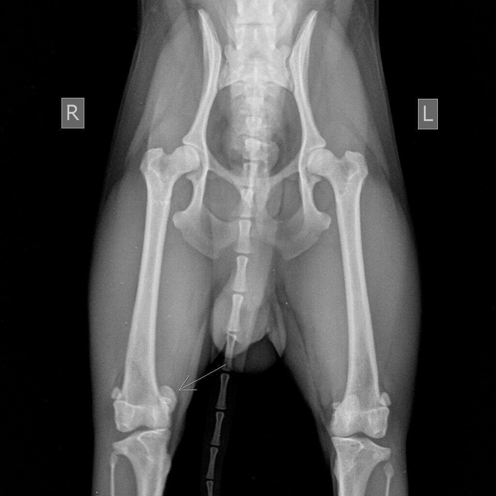 vyvih-patelly-pravogo-kolennogo-sustava-u-jorka-1024x1024 Диагностика вывиха коленной чашечки (Patella luxation)