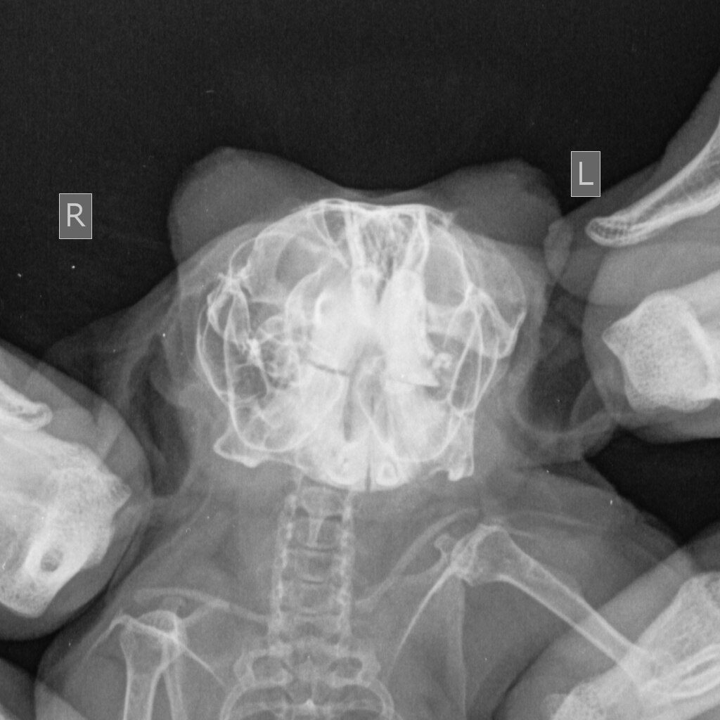 anomalnyj-rost-zubov-u-shinshill-4-1024x1024 Стоматология грызунов и зайцеобразных