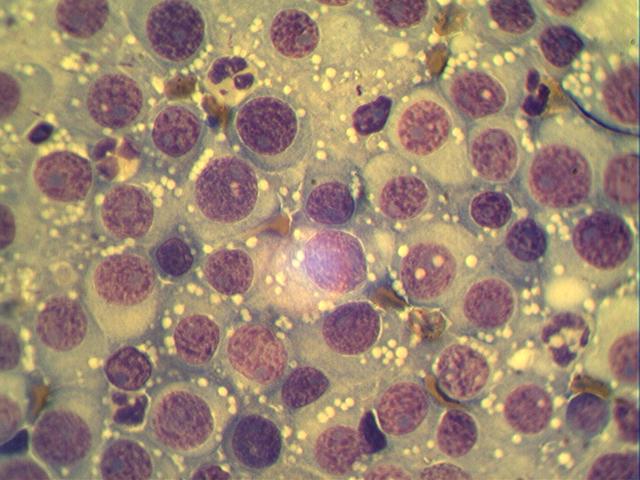 tvs Цитологическое исследование