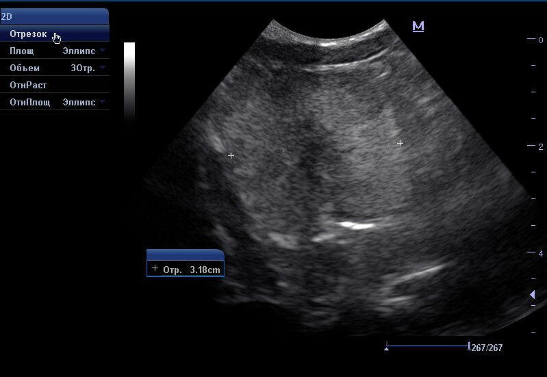 predstatelnaya-zheleza-kobelya-porody-labrador УЗ-исследование предстательной железы