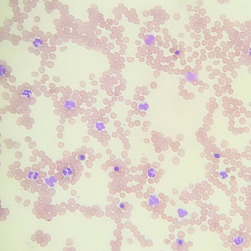 eritrocity-1024x1024 Общий анализ крови (ОАК). Что скрывает в себе кровь?