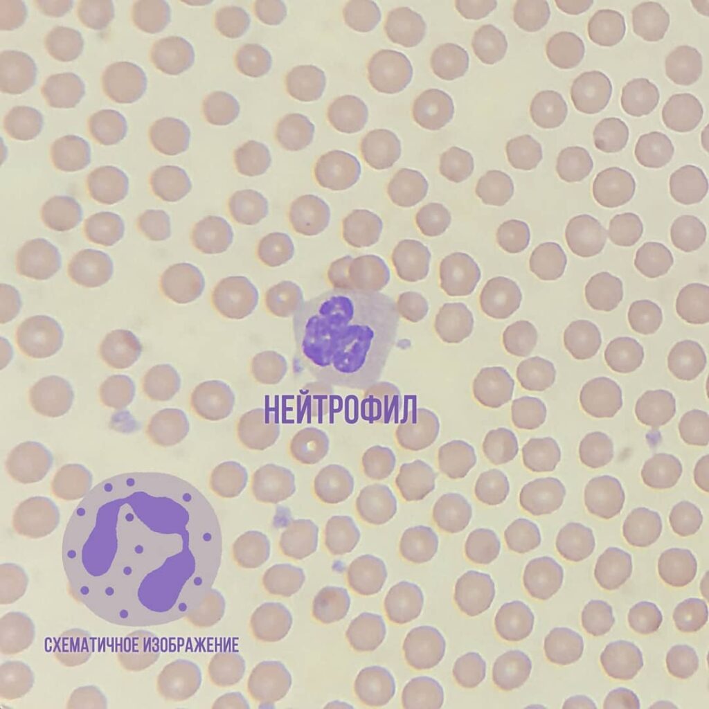 nejtrofil-1024x1024 Общий анализ крови (ОАК). Лейкоциты