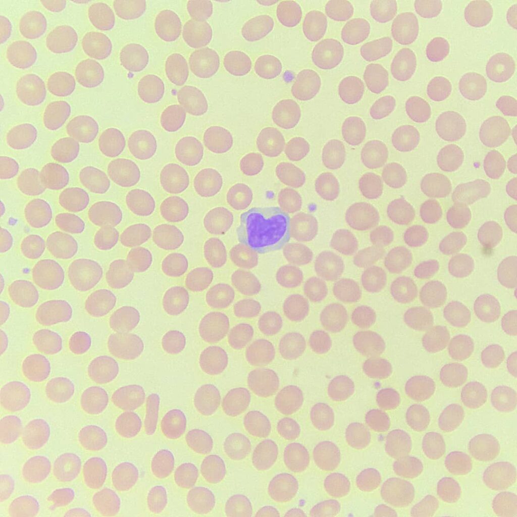 trombocity-1024x1024 Общий анализ крови (ОАК). Что скрывает в себе кровь?