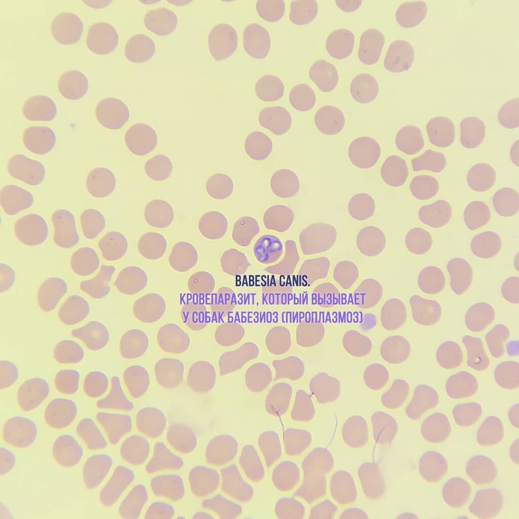 babesia-canis-1024x1024 Общий анализ крови (ОАК). Эритроциты