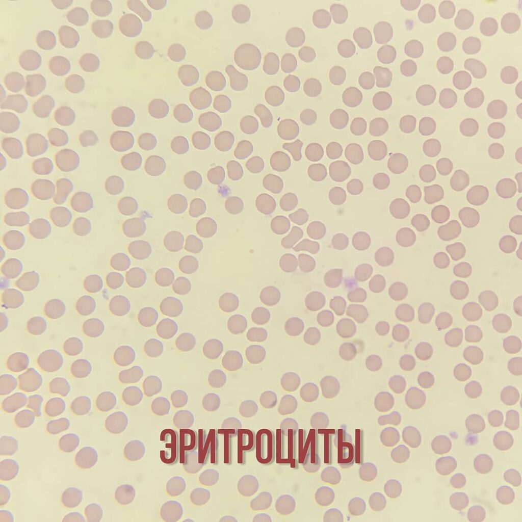 eritrocity-1024x1024 Общий анализ крови (ОАК). Эритроциты