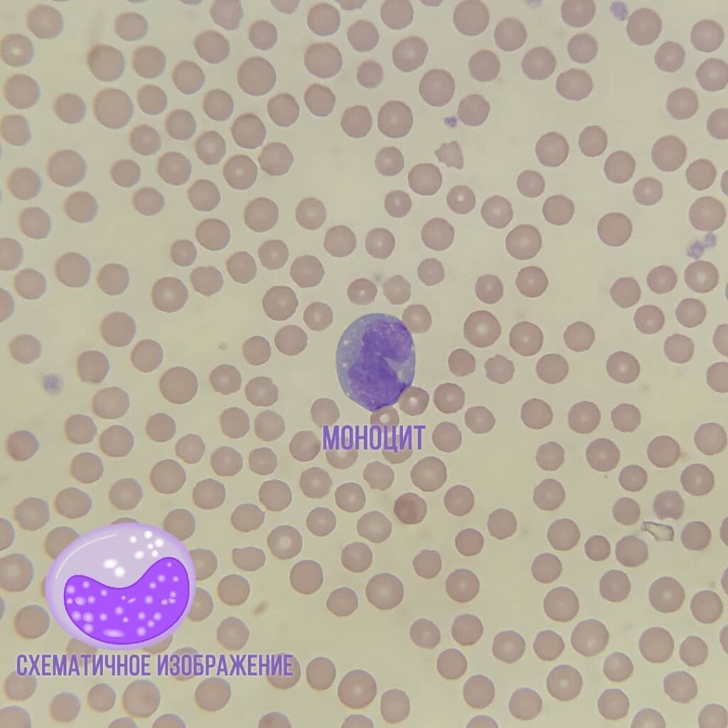 monocit-1024x1024 Общий анализ крови (ОАК). Лейкоциты (ч. 2)