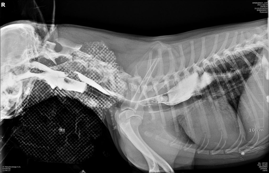 snimok-diagnostika-i-lechenie-megaezofagusa-2-1024x658 Диагностика и лечение мегаэзофагуса