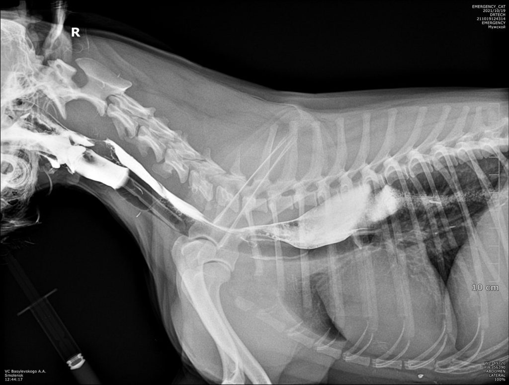 snimok-diagnostika-i-lechenie-megaezofagusa-3-1024x775 Диагностика и лечение мегаэзофагуса