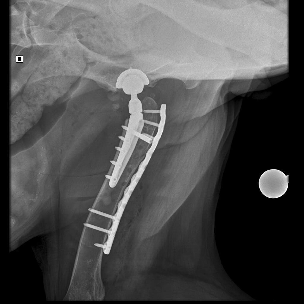endoprotezirovanie-zamena-tazobedrennogo-sustava_1-1024x1024 Эндопротезирование (замена) тазобедренного сустава