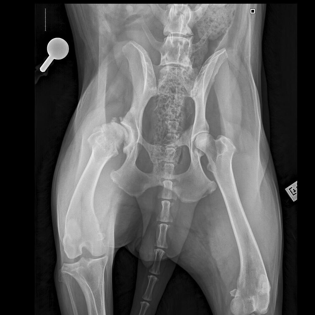 endoprotezirovanie-zamena-tazobedrennogo-sustava_3-1024x1024 Эндопротезирование (замена) тазобедренного сустава