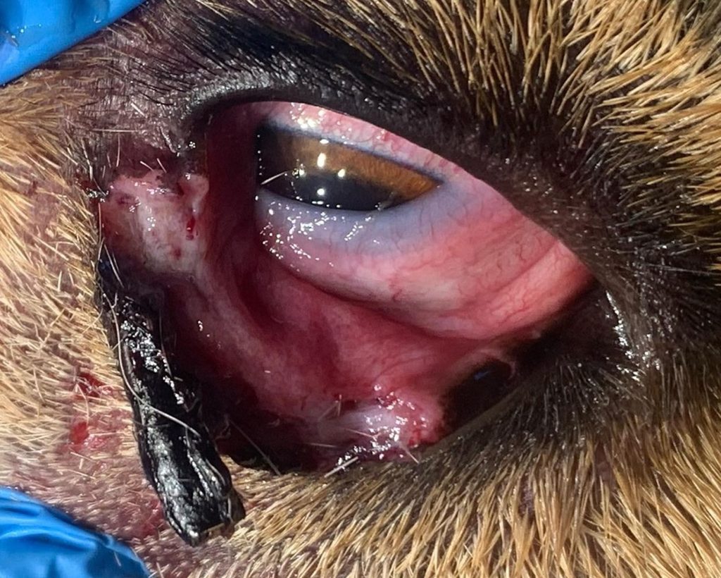 otorvannoe-nizhnee-veko-do-operacii-1024x820 Клинический случай: хирургическая пластика века