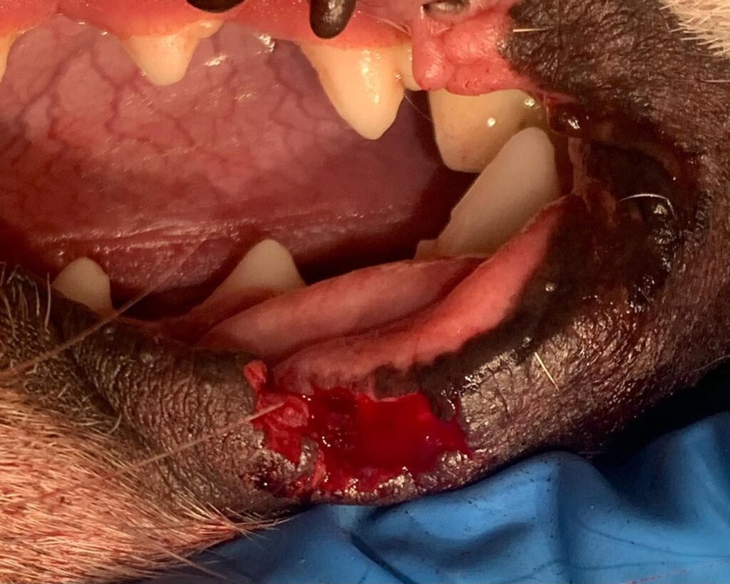 peresadka-tkani-s-guby-na-veko-1024x819 Клинический случай: хирургическая пластика века