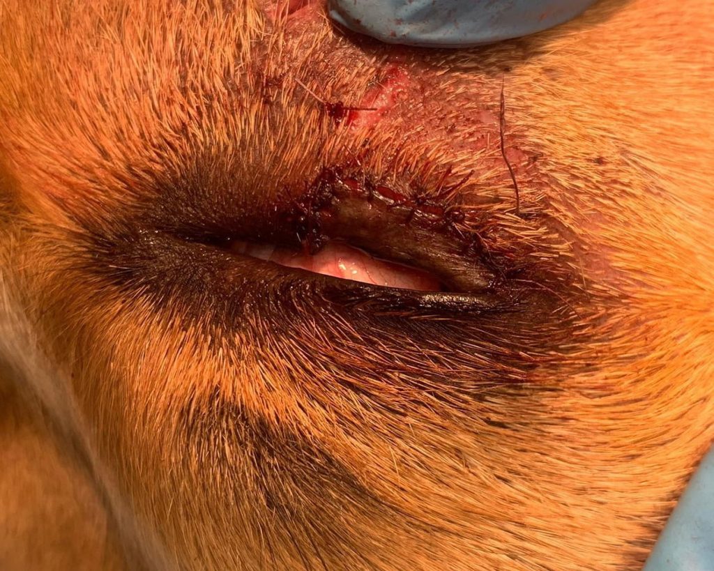 rezultat-srazu-posle-operacii-nad-otorvannym-nizhnim-vekom-1024x819 Клинический случай: хирургическая пластика века