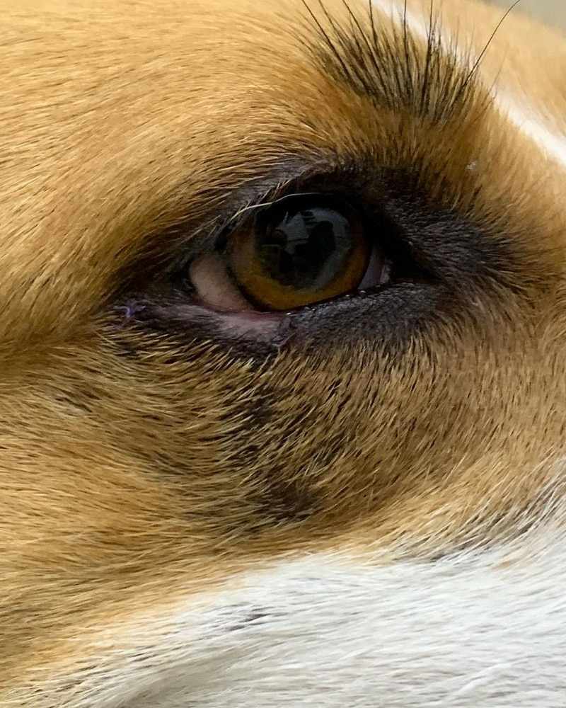 veko-posle-operacii Клинический случай: хирургическая пластика века