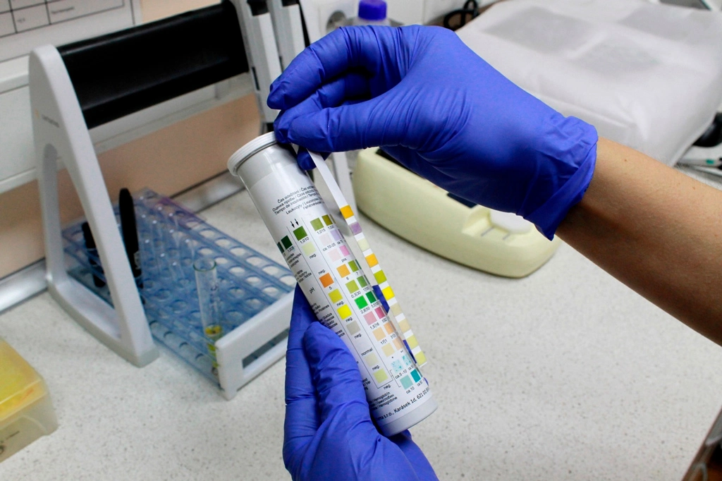 analiz-mochi-bakteriologicheskiy Анализ мочи бактериологический