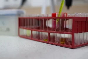 analiz-mochi-biohimicheskiy-1-300x200 Анализ мочи биохимический (соотношение белок/креатинин)