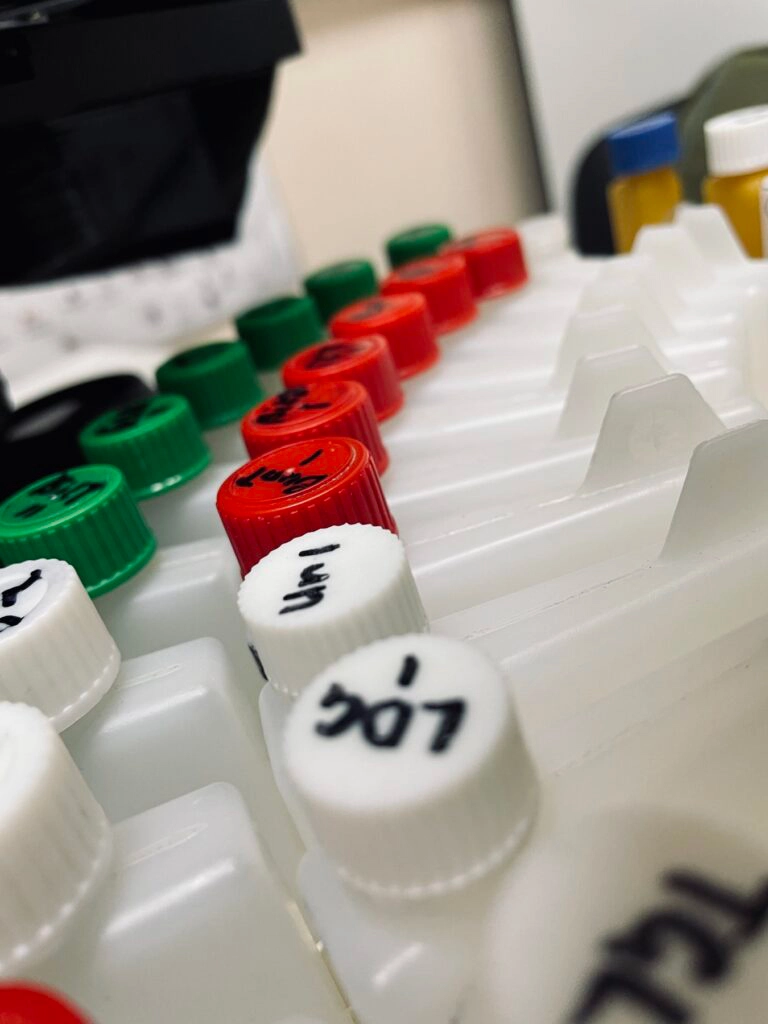 biohimicheskiy-analiz-krovi Анализ крови биохимический