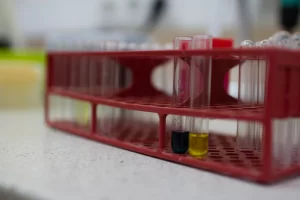 biohimicheskiy-analiz-mochi-300x200 Анализ мочи биохимический (соотношение белок/креатинин)