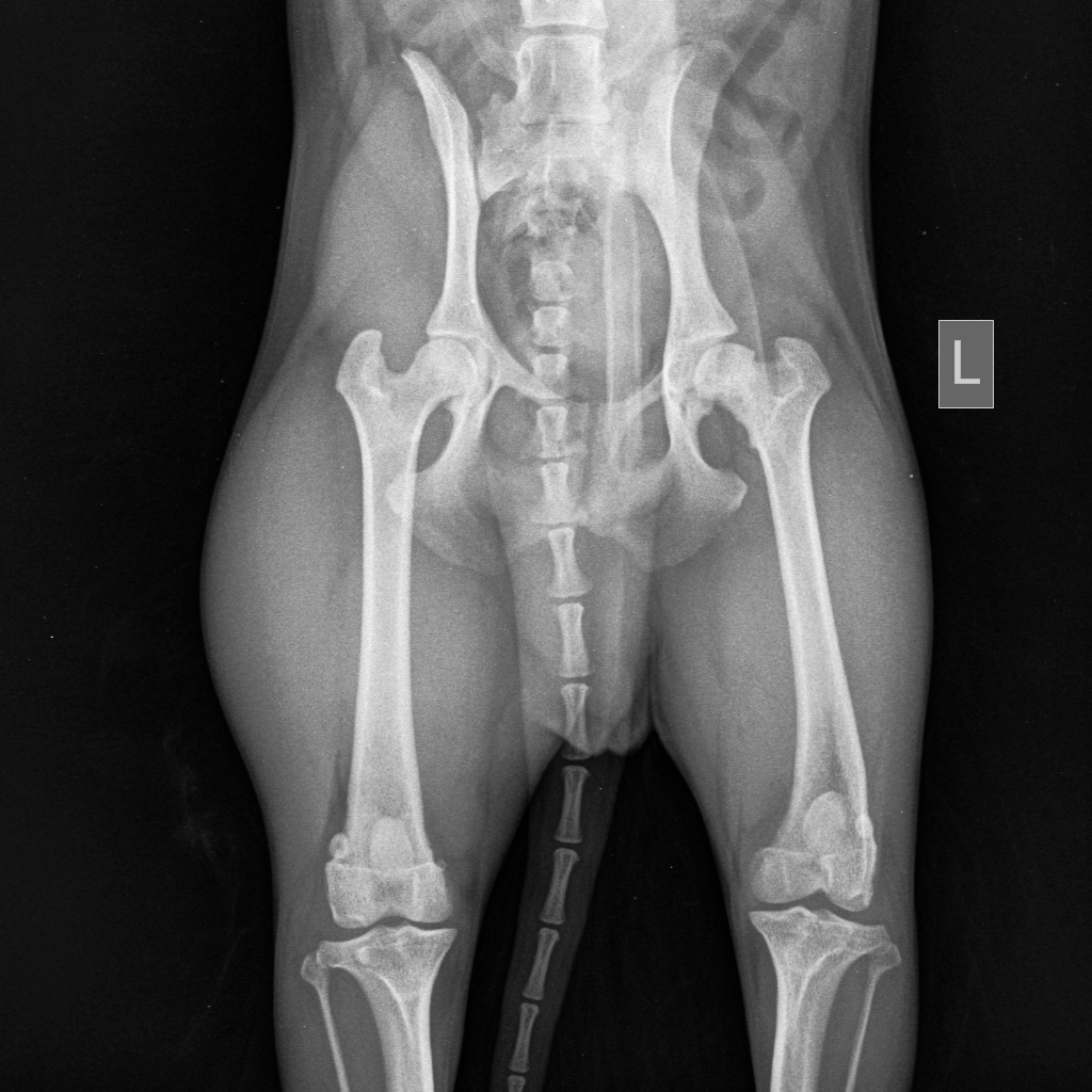 pertesa Диагностика и лечение болезни Пертеса