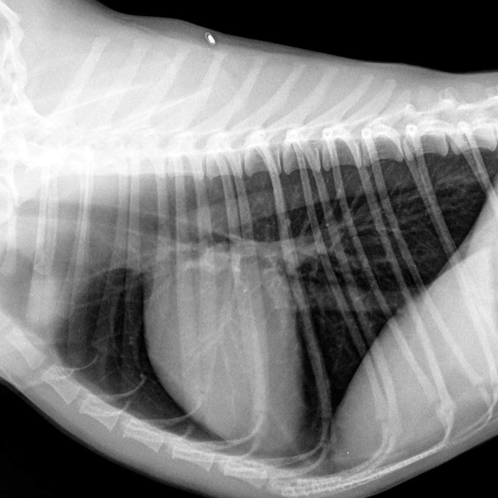 rentgen-snimok-grudnogo-poyasnogo-otdela Общая информация по кардиологии