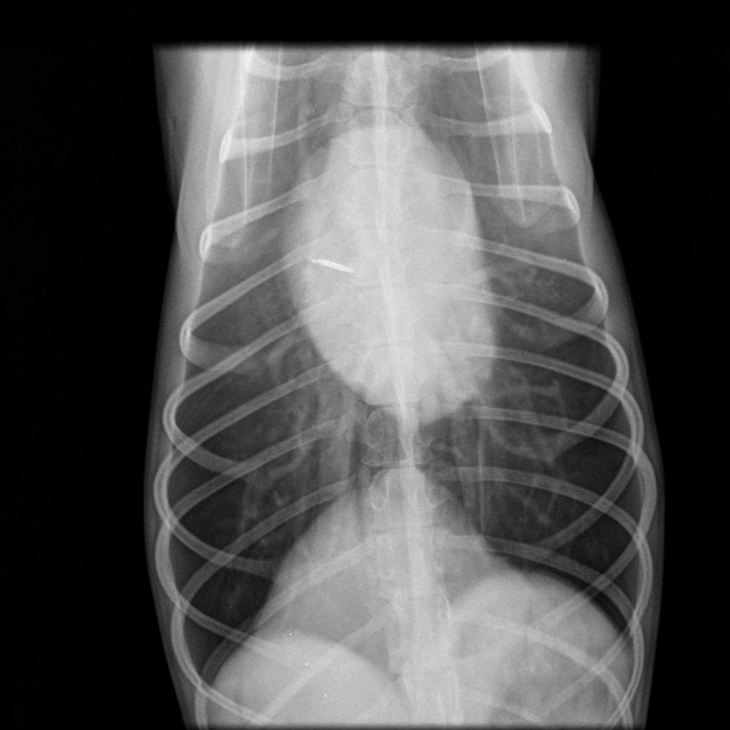 rentgen-snimok-grudnoy-kletki Общая информация по кардиологии