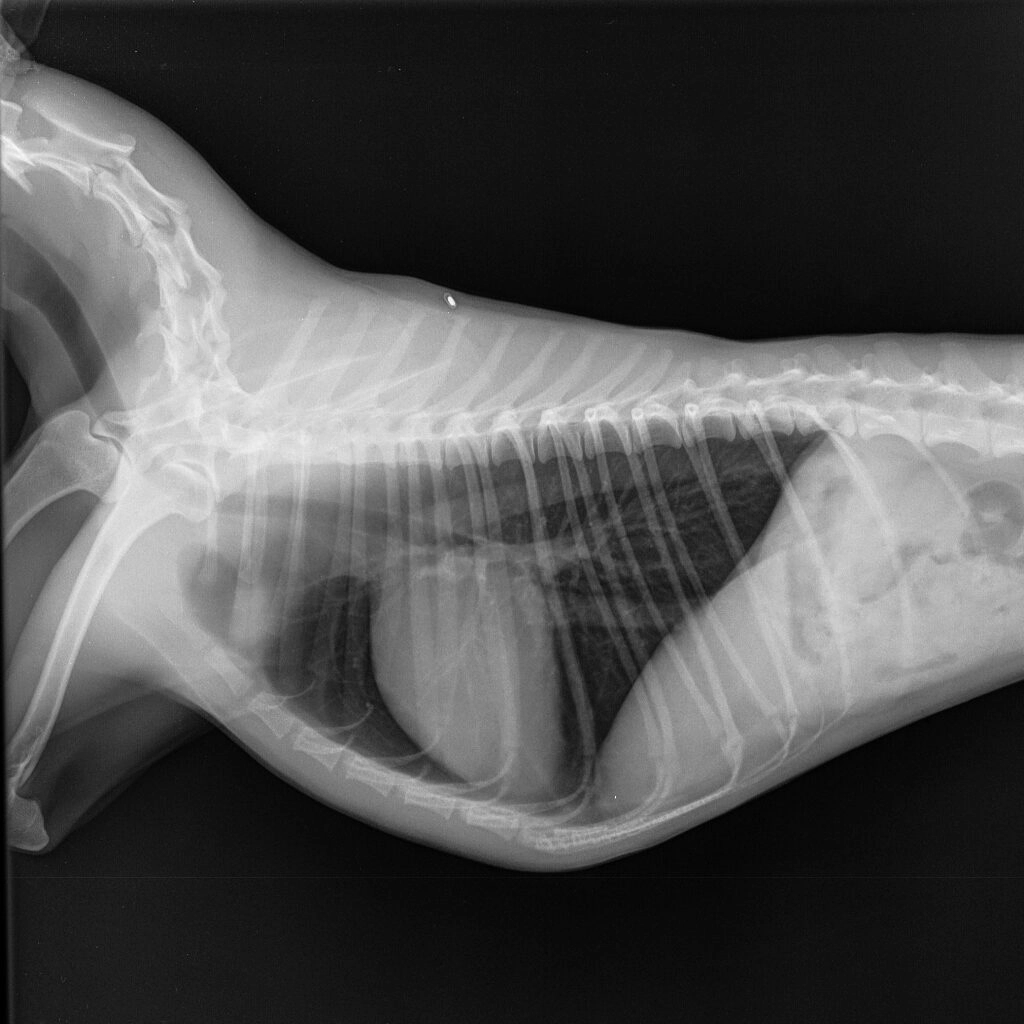 rentgen-snimok-grudnoy-poyasnoy-otdel Общая информация по кардиологии