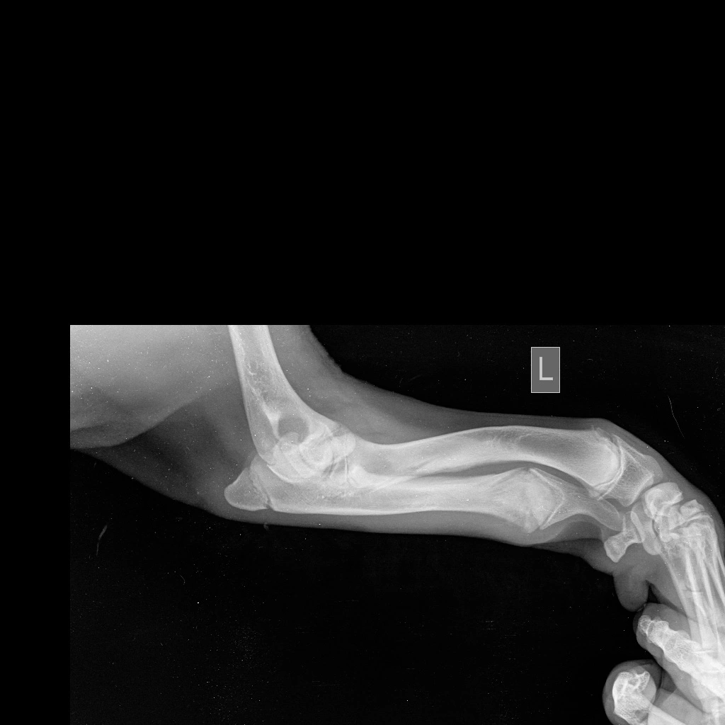 skelet-krupnyy-lapa-zhivotnogo Диагностика и лечение синдрома укороченной локтевой кости