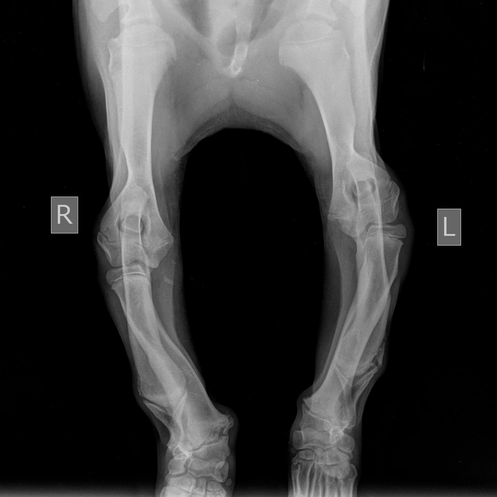 skelet-krupnyy-zapyaste Диагностика и лечение синдрома укороченной локтевой кости