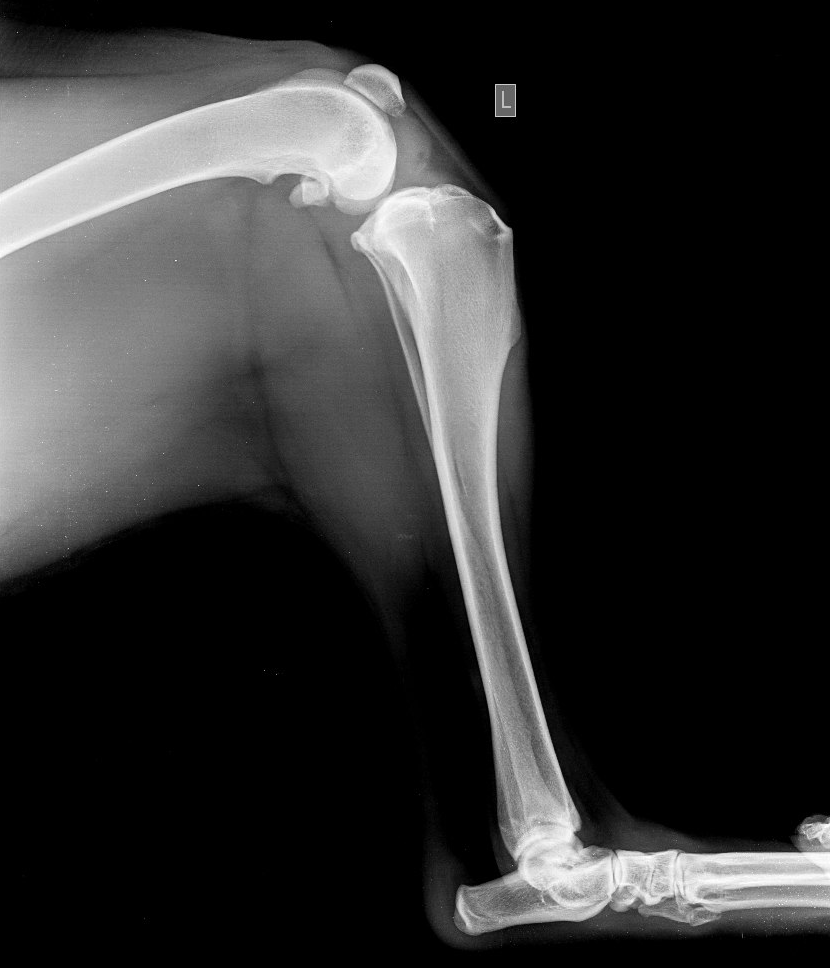 diagnostika-i-lechenie-razryva-pks-tplo_2 Диагностика и лечение разрыва ПКС, TPLO