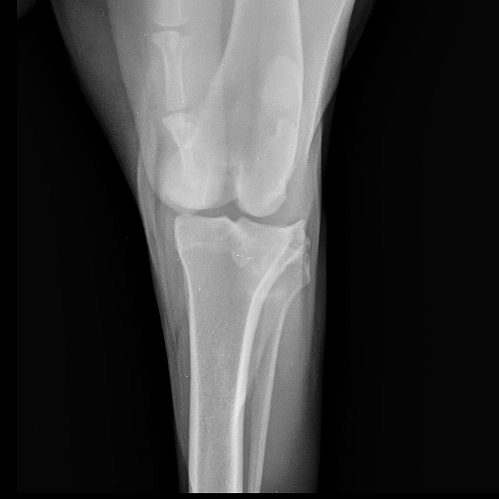 diagnostika-i-lechenie-razryva-pks-tplo_3 Диагностика и лечение разрыва ПКС, TPLO