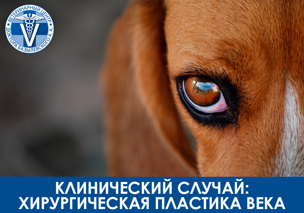Клинический случай: хирургическая пластика века